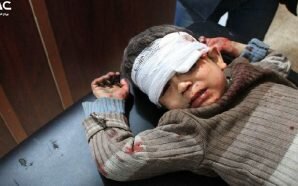 الأمم المتحدة تتهم نظام الأسد بالمساومة على إجلاء الأطفال المرضى…